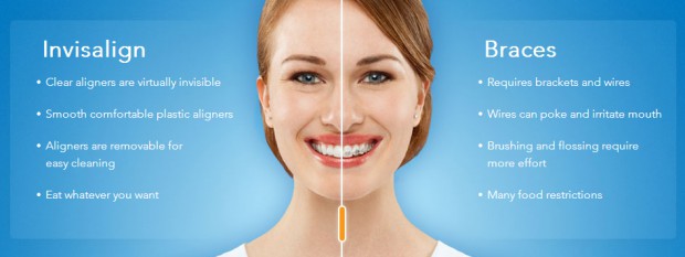 Cosmetic Dental Bonding