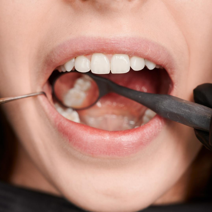 Dental Exam & Cleanings